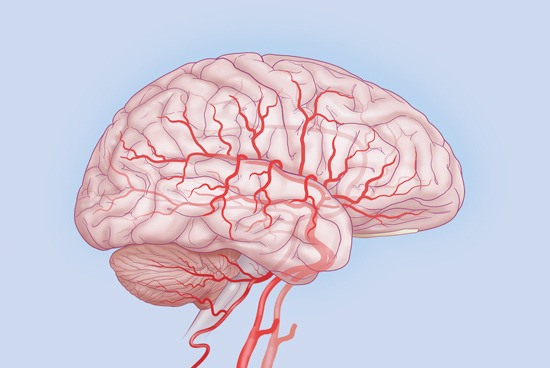 A stroke is a disease that affects the arteries leading to the brain and within the brain. Strokes can happen when blood vessels that carry oxygen to the brain becomes clotted or bursts. This means the brain can’t get the blood it needs to function