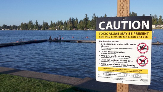 The sign at Lake Tapps warning swimmers about toxic algae has been removed since the Tacoma-Pierce County Health Department has found no toxic algae in the lake for two consecutive weeks.
