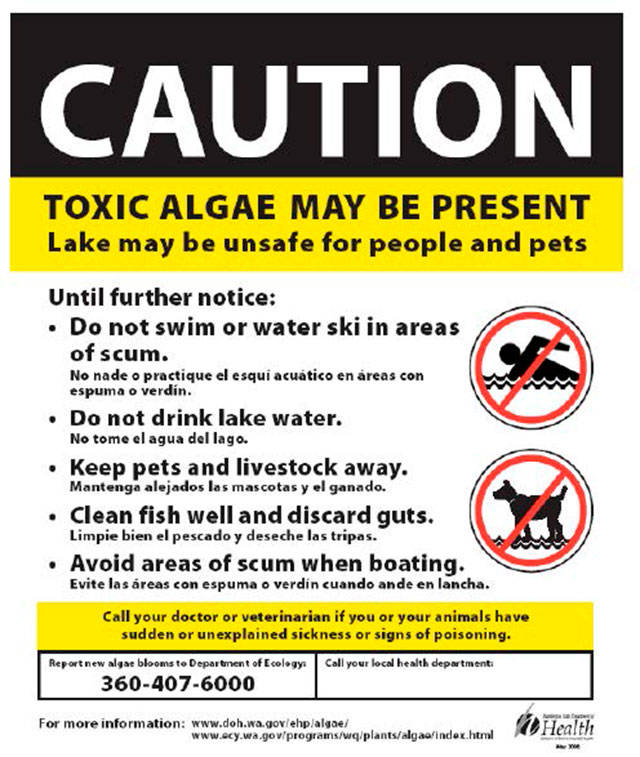 Health department warns of potential toxic algae