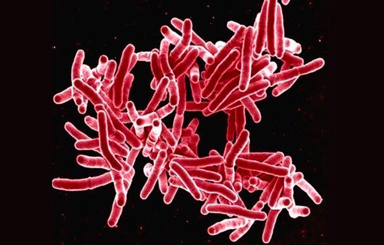 It’s estimated 100,000 people in King County are infected with tuberculosis bacteria, even though they may not be infectious or show symptoms. Contributed photo