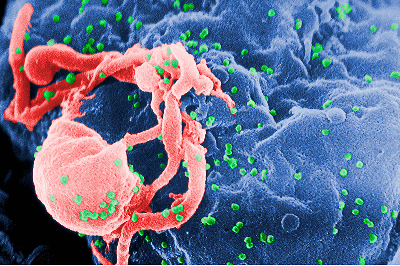 Scanning electron micrograph of HIV-1 (in green) budding from cultured lymphocyte. Multiple round bumps on cell surface represent sites of assembly and budding of virions. Image courtesy Wikipedia Commons