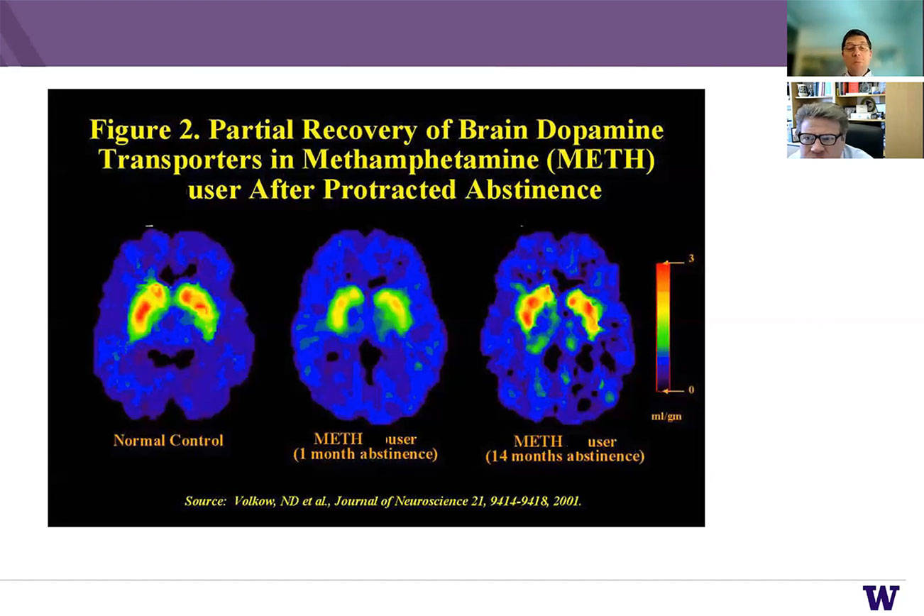 Dr. Caleb Banta-Green shows research on how the brain recovers after about a year of sobriety from the abuse of methamphetamine during the virtual meeting April 14.