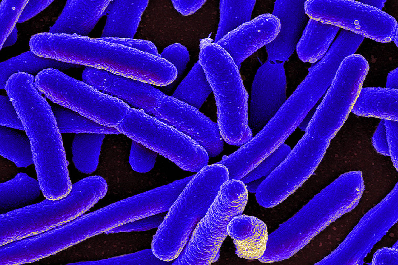 “E. coli Bacteria” by <a href="https://www.flickr.com/photos/niaid/" target="_blank">NIAID</a> is licensed under <a href="https://creativecommons.org/licenses/by/2.0/" target="_blank">CC BY 2.0</a>