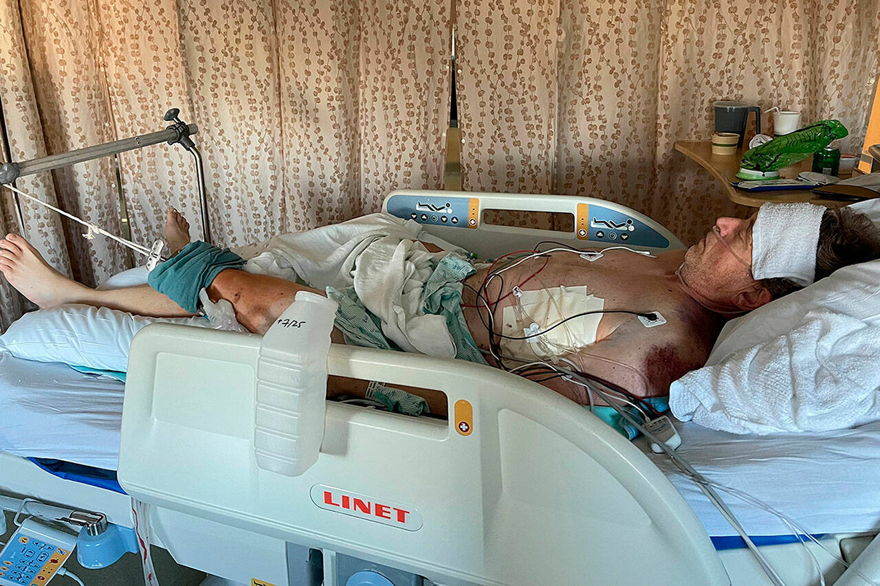 Mark Gringle suffered extensive injuries after being pushed off his bike during a road rage altercation. Submitted photo