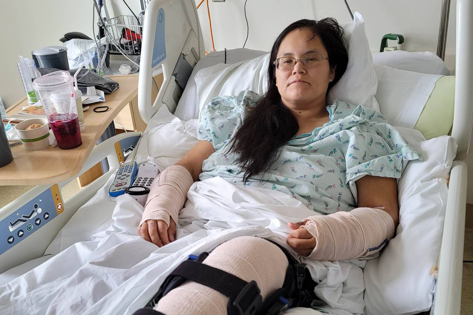 Lareina Lucas was in a Washington State hospital for almost a week with broken bones after a vehicle collision on April 8. Photo courtesy Ha-Shilth-Sa/(Submitted photo)