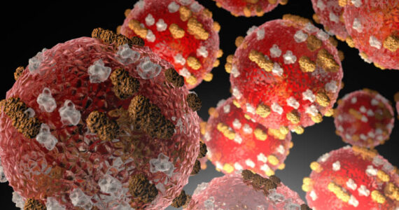 Measles is very contagious and can be serious; the Center for Disease Control and Prevention recommends two doses of MMR vaccine provide the best protection against measles. Image courtesy Center for Disease Control and Prevention