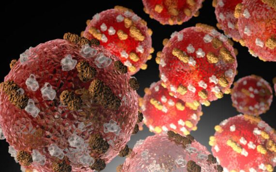 Measles is very contagious and can be serious; the Center for Disease Control and Prevention recommends two doses of MMR vaccine provide the best protection against measles. Image courtesy Center for Disease Control and Prevention