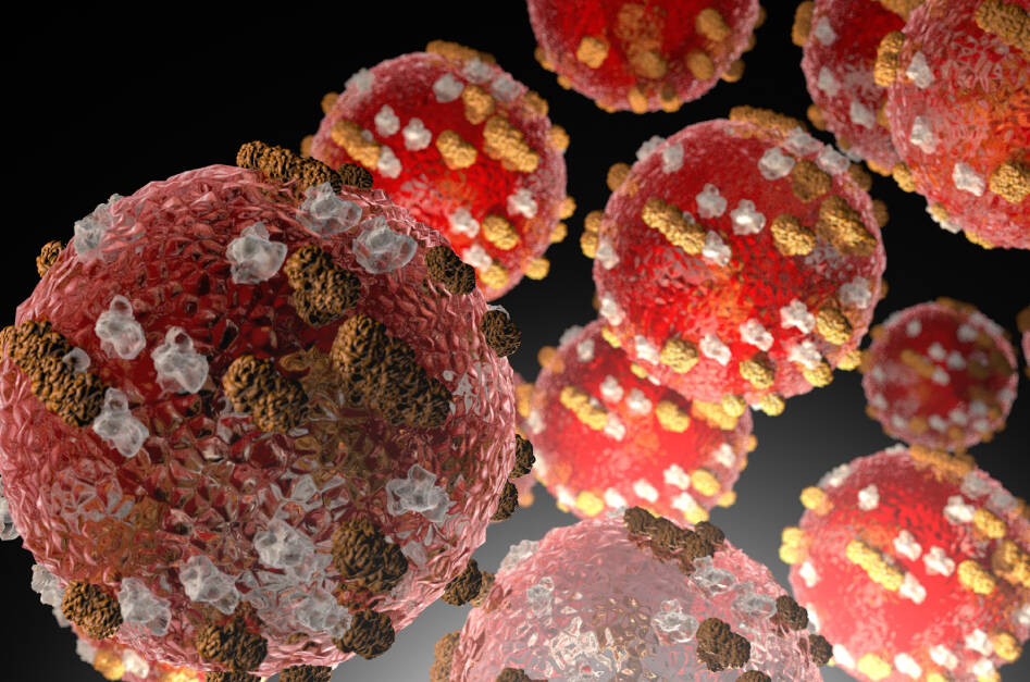 Measles is very contagious and can be serious; the Center for Disease Control and Prevention recommends two doses of MMR vaccine provide the best protection against measles. Image courtesy Center for Disease Control and Prevention