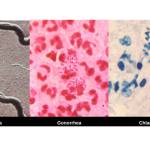 A tale of three STIs | Public Health Insider