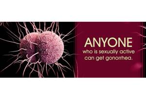 Antibiotic resistant gonorrhea found in King County | Public Health Insider