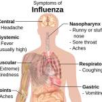 Image courtesy Häggström; Mikael (2014). Medical gallery of Mikael Häggström 2014. WikiJournal of Medicine 1 (2). DOI:10.15347/wjm/2014.008. ISSN 2002-4436. Public Domain.