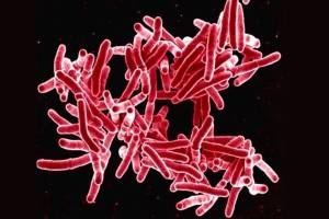 Time to bring the heat on tuberculosis | Public Health Insider