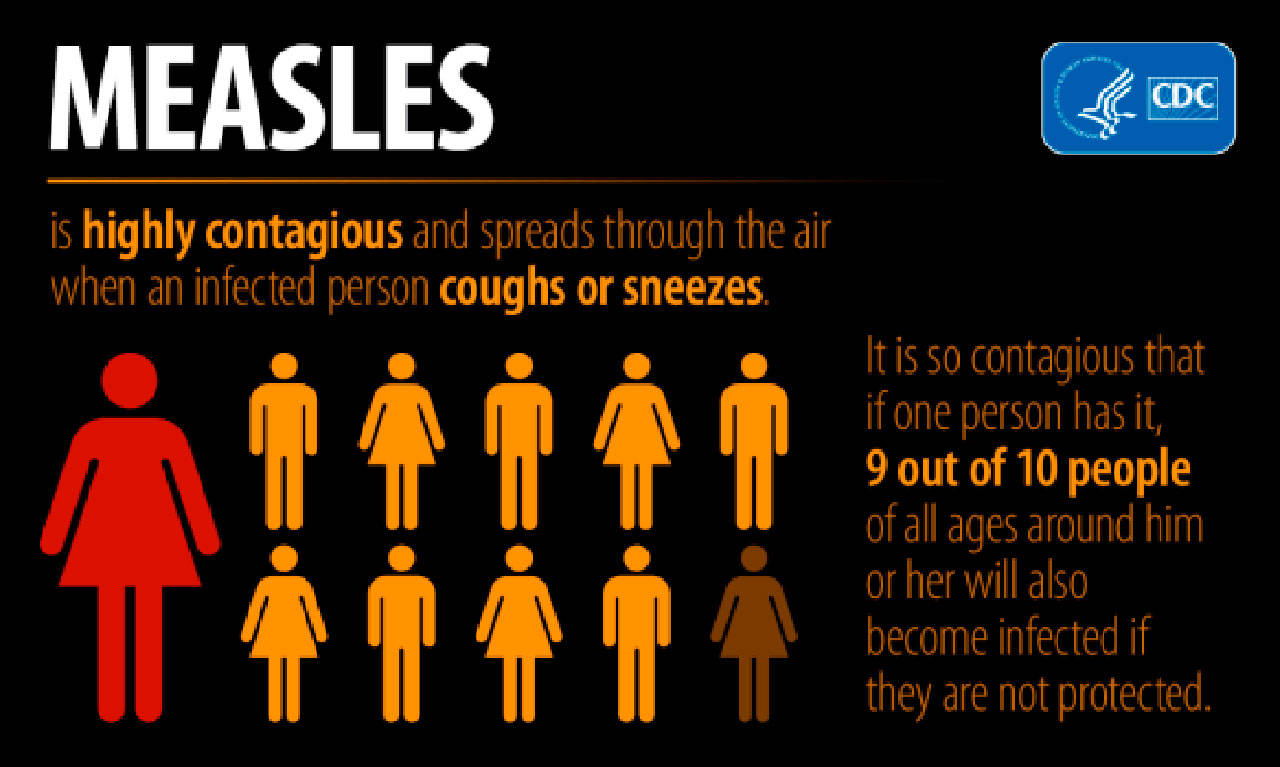 Update: King, Clark county measles cases confirmed | Department of Health