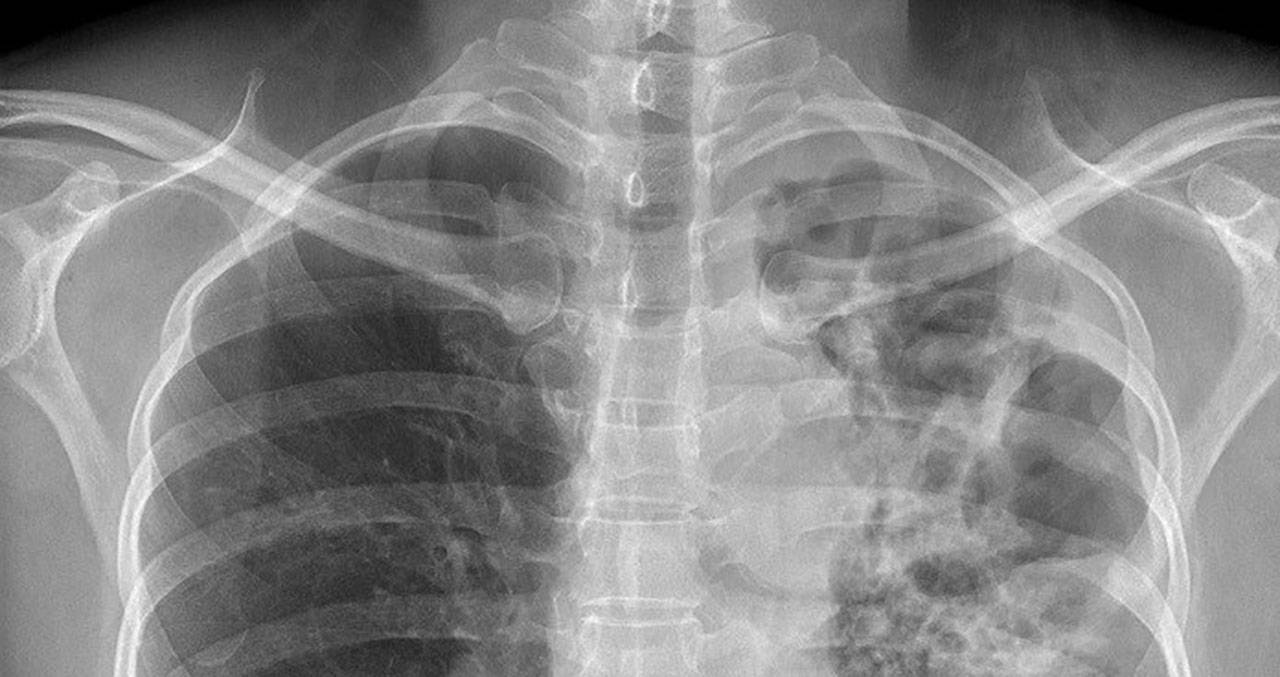 Image courtesy Public Health Insider.