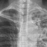 Image courtesy Public Health Insider.