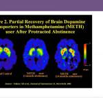 Dr. Caleb Banta-Green shows research on how the brain recovers after about a year of sobriety from the abuse of methamphetamine during the virtual meeting April 14.