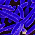 E. coli Bacteria by <a href="https://www.flickr.com/photos/niaid/" target="_blank">NIAID</a> is licensed under <a href="https://creativecommons.org/licenses/by/2.0/" target="_blank">CC BY 2.0</a>