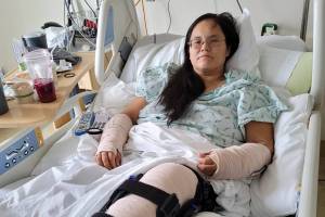 Lareina Lucas was in a Washington State hospital for almost a week with broken bones after a vehicle collision on April 8. Photo courtesy Ha-Shilth-Sa/(Submitted photo)